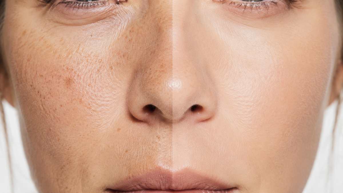 Red Light Therapy Mask