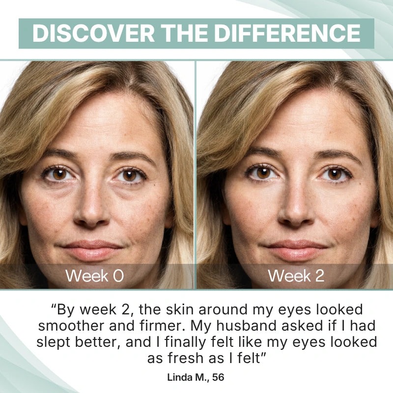 PDRN Eye Lifter