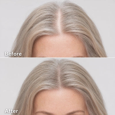 Root Shot Serum - PDRN Scalp Hair Brush
