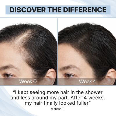 PDRN Scalp Brush Serum