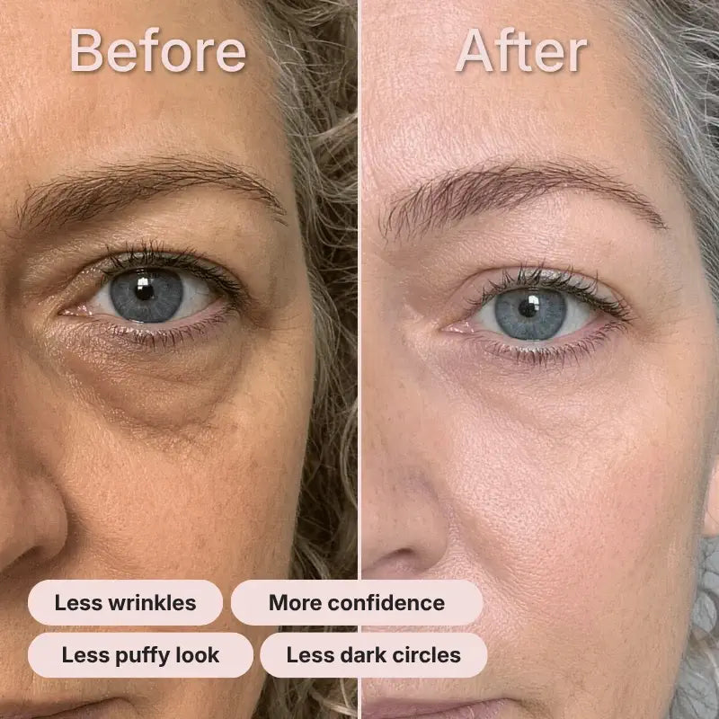 Microneedling Eye Patch