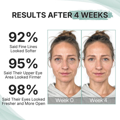 PDRN Eye Lifter